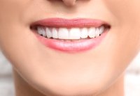 Close-up of woman’s smile after visiting cosmetic dentist in State College, PA